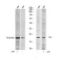 Anti-Phospho-TIFA-Thr9 antibody (STJ198347) – Figure 1 of 1
