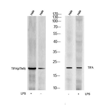Anti-Phospho-TIFA-Thr9 antibody (STJ198347) – Figure 1 of 1