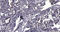 Anti-PPP1R26 antibody (STJ198353) – Figure 1 of 1