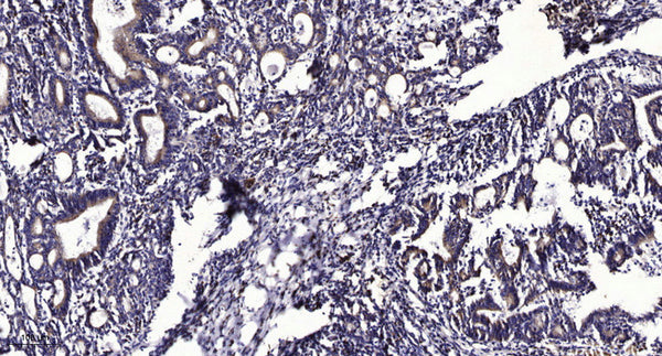 Anti-PPP1R26 antibody (STJ198353) – Figure 1 of 1