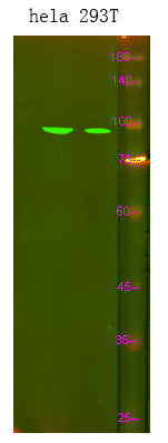 Anti-SPINK7 antibody (1-50 aa) (STJ198359) – Figure 1 of 1
