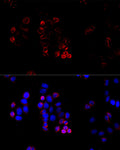 Anti-ABCG8 antibody (1-320) (STJ22469) – Figure 1 of 1