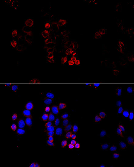 Anti-ABCG8 antibody (1-320) (STJ22469) – Figure 1 of 1