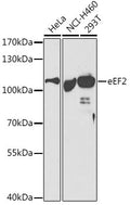 Anti-EEF2 antibody (1-290) (STJ23480) – Figure 1 of 1