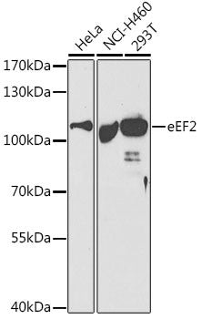 Anti-EEF2 antibody (1-290) (STJ23480) – Figure 1 of 1