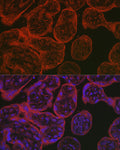 Anti-NOS3 antibody (1000-1203) (STJ24784) – Figure 1 of 1