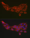 Anti-PDK1 antibody (337-436) (STJ24945) – Figure 1 of 1