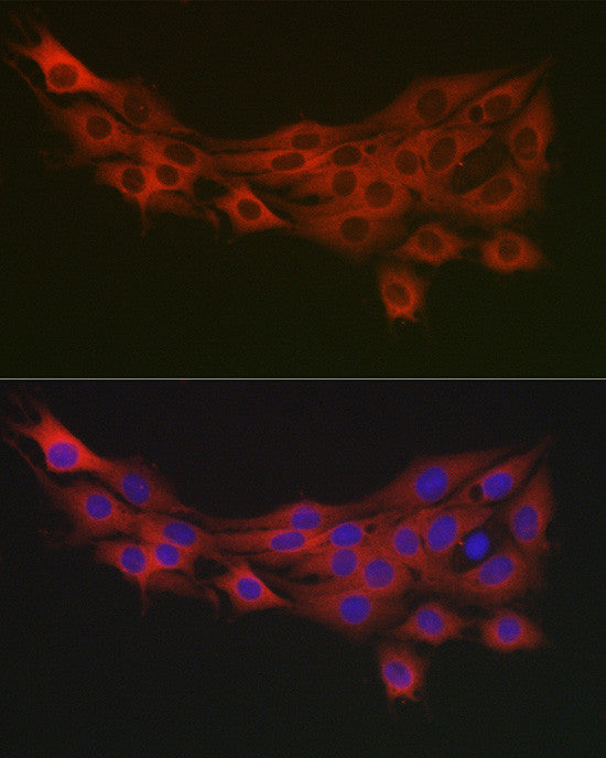 Anti-PDK1 antibody (337-436) (STJ24945) – Figure 1 of 1