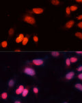 Anti-SIRT1 antibody (229-246) (STJ25533) – Figure 1 of 1