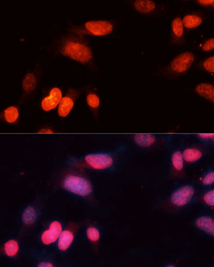 Anti-SIRT1 antibody (229-246) (STJ25533) – Figure 1 of 1