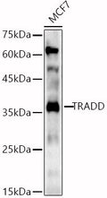Anti-TRADD antibody (199-312) (STJ25949) – Figure 1 of 1