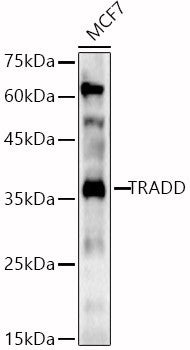 Anti-TRADD antibody (199-312) (STJ25949) – Figure 1 of 1