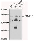 Anti-CAMK1G antibody (217-476) (STJ29516) – Figure 1 of 1