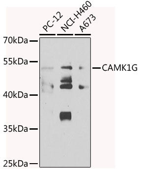 Anti-CAMK1G antibody (217-476) (STJ29516) – Figure 1 of 1