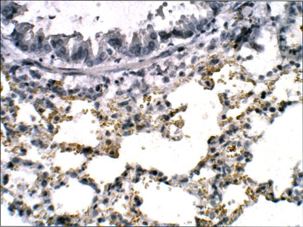 Anti-C6orf150 antibody (450-500) (STJ500504) – Figure 1 of 1