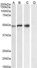 Anti-NCF1/p47phox antibody (C-Term) (STJ70023) – Figure 1 of 1
