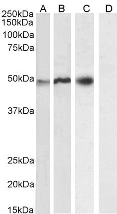 Anti-NCF1/p47phox antibody (C-Term) (STJ70023) – Figure 1 of 1