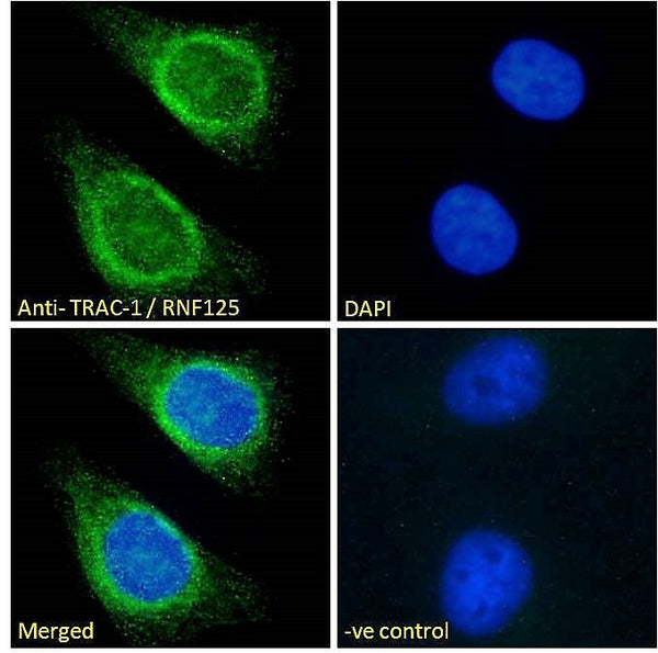 Anti-TRAC-1/RNF125 antibody (C-Term) (STJ70554) – Figure 1 of 1