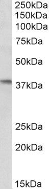 Anti-AIM2 antibody (Internal) (STJ72168) – Figure 1 of 1