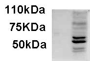 Anti-AIM2 antibody (C-Term) (STJ72169) – Figure 1 of 1