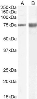 Anti-JIP1/MAPK8IP1 antibody (Internal) (STJ73583) – Figure 1 of 1