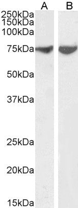 Anti-JIP1/MAPK8IP1 antibody (265-279) (STJ73584) – Figure 1 of 1