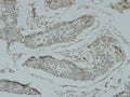 Anti-ACR antibody (40-120 aa) (STJ90000) – Figure 1 of 1