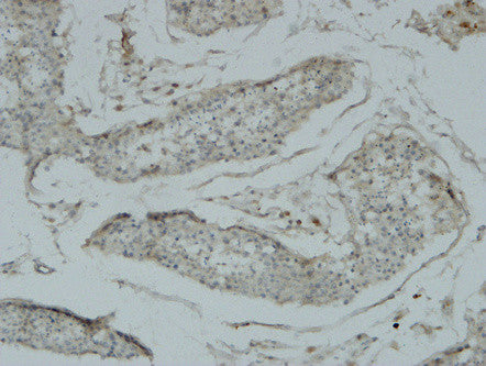 Anti-ACR antibody (40-120 aa) (STJ90000) – Figure 1 of 1