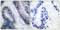 Anti-Cleaved-CASP1-M211 antibody (192-241 aa) (STJ90002) – Figure 1 of 1