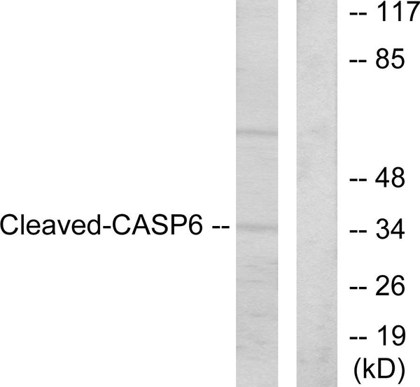 Anti-Cleaved-CASP6-D162 antibody (144-193 aa) (STJ90006) – Figure 1 of 1