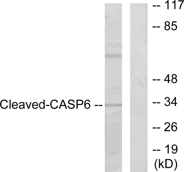Anti-Cleaved-CASP6-D179 antibody (130-179 aa) (STJ90007) – Figure 1 of 1