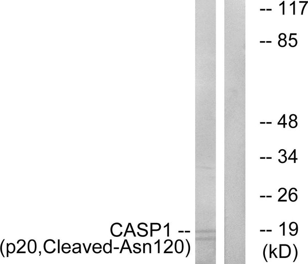 Anti-Cleaved-CASP1-N120 antibody (101-150 aa) (STJ90021) – Figure 1 of 1