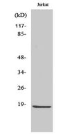 Anti-Cleaved-CASP2-G170 antibody (151-200 aa) (STJ90023) – Figure 1 of 1