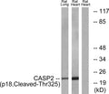 Anti-Cleaved-CASP2-T325 antibody (276-325 aa) (STJ90024) - Figure 1 of 1