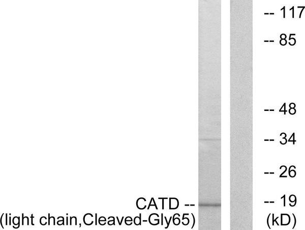 Anti-Cleaved-CTSD-G65 antibody (46-95 aa) (STJ90037) – Figure 1 of 1