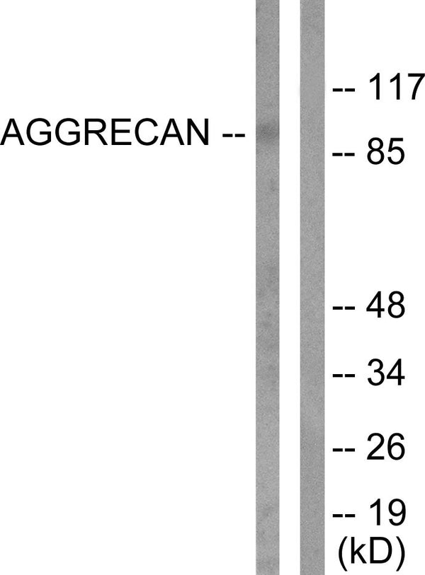 Anti-Cleaved-ACAN-D369 antibody (320-369 aa) (STJ90041) – Figure 1 of 1