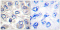 Anti-Cleaved-Bad-D71 antibody (21-70 aa) (STJ90042) – Figure 1 of 1