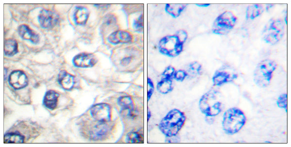 Anti-Cleaved-Bad-D71 antibody (21-70 aa) (STJ90042) – Figure 1 of 1