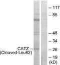 Anti-Cleaved-CTSZ-L62 antibody (43-92 aa) (STJ90045) – Figure 1 of 1
