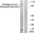 Anti-Cleaved-COL3A1-G1221 antibody (1172-1221 aa) (STJ90049) - Figure 1 of 2