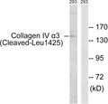 Anti-Cleaved-COL4A3-L1425 antibody (1376-1425 aa) (STJ90050) – Figure 1 of 1