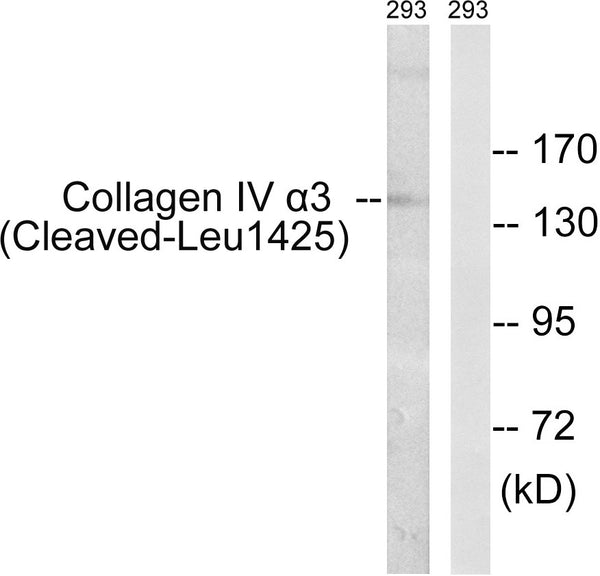 Anti-Cleaved-COL4A3-L1425 antibody (1376-1425 aa) (STJ90050) – Figure 1 of 1