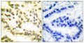 Anti-Cleaved-LMNA-D230 antibody (181-230 aa) (STJ90056) – Figure 1 of 1