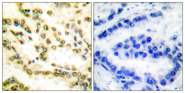 Anti-Cleaved-LMNA-D230 antibody (181-230 aa) (STJ90056) – Figure 1 of 1
