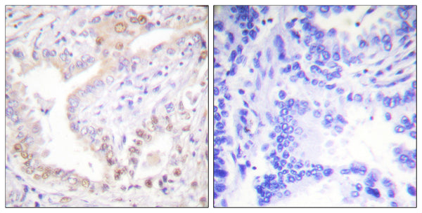 Anti-Cleaved-LMNA-N231 antibody (212-261 aa) (STJ90057) – Figure 1 of 1