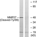 Anti-Cleaved-MMP27-Y99 antibody (80-129 aa) (STJ90064) – Figure 1 of 1