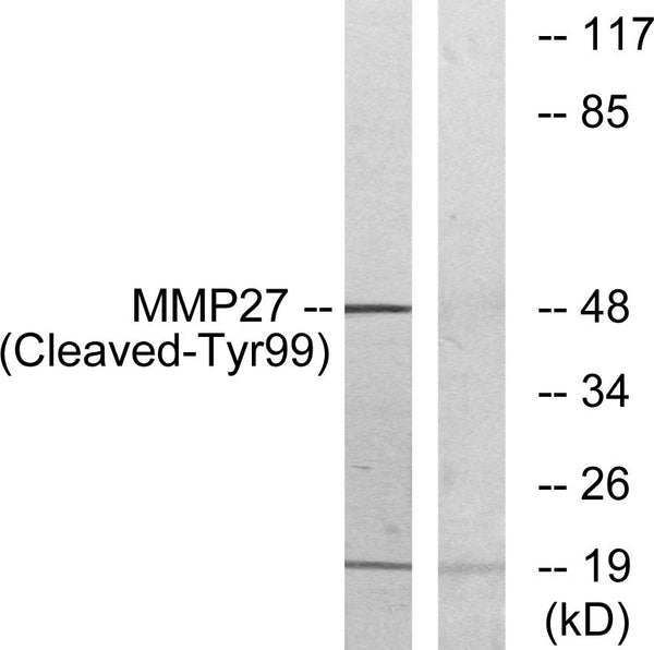 Anti-Cleaved-MMP27-Y99 antibody (80-129 aa) (STJ90064) – Figure 1 of 1
