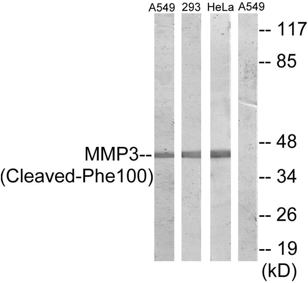Anti-Cleaved-MMP3-F100 antibody (81-130 aa) (STJ90065) – Figure 1 of 1