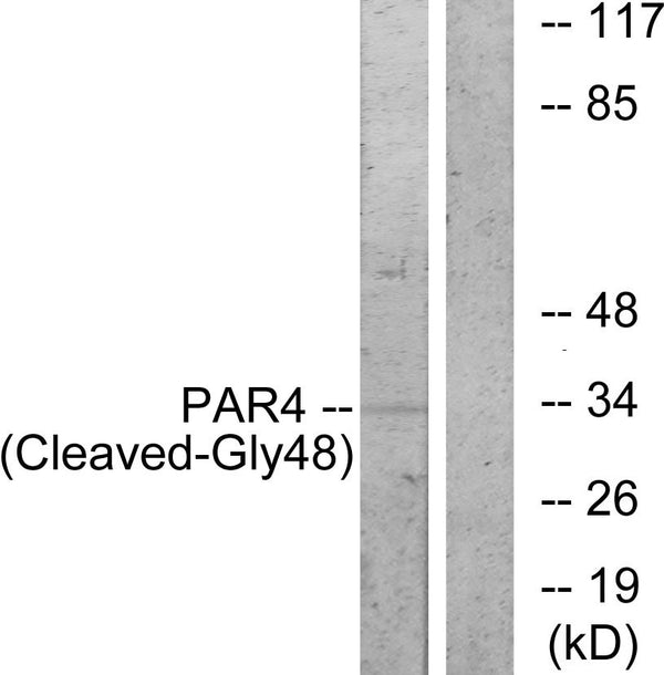 Anti-Cleaved-F2RL3-G48 antibody (29-78 aa) (STJ90071) – Figure 1 of 1