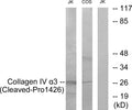 Anti-Cleaved-COL4A3-P1426 antibody (1407-1456 aa) (STJ90077) – Figure 1 of 1